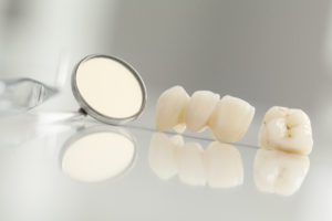 dental crowns on a table