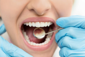 Dental examination on woman 